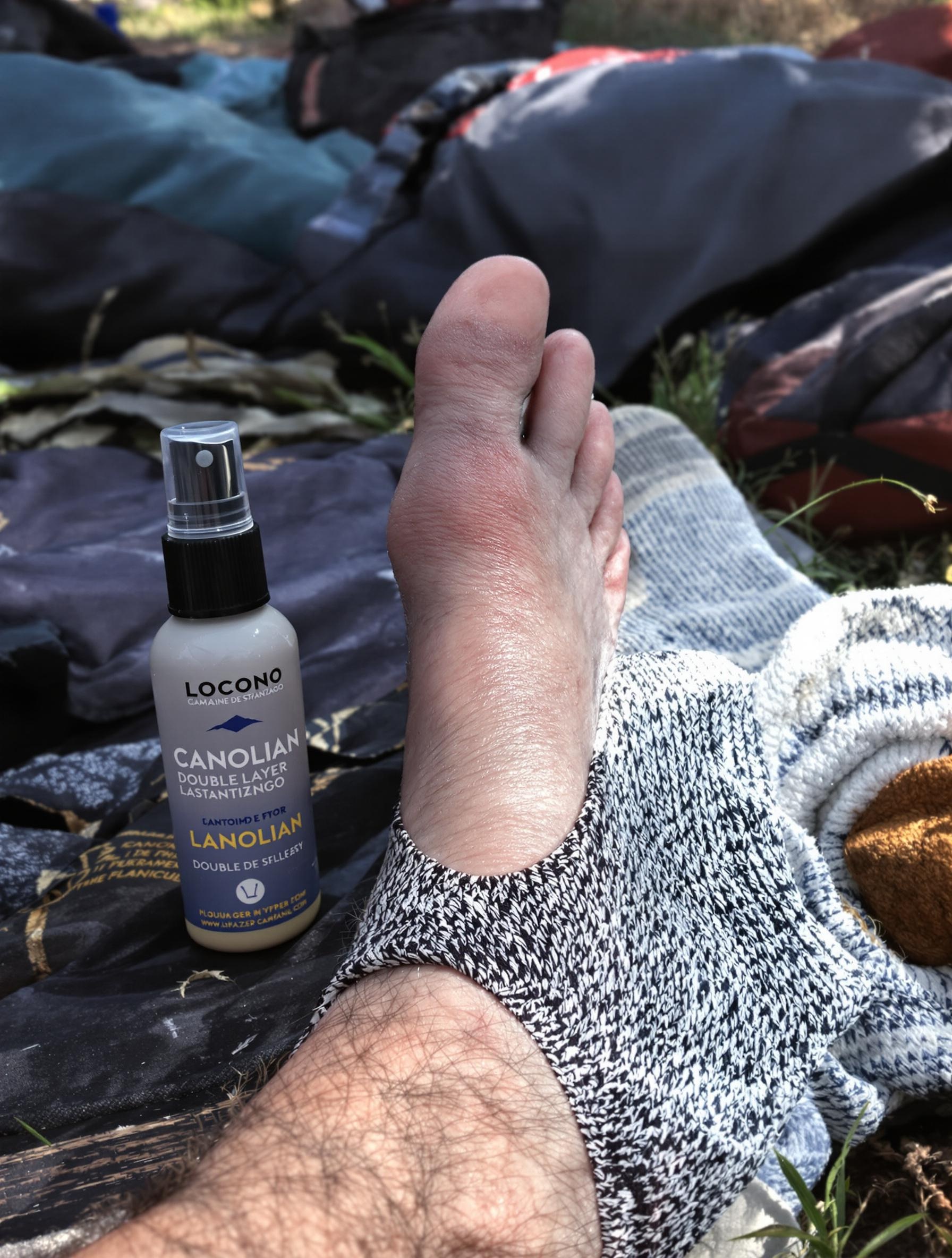 soins ampoule spray lanoline double chaussette chemin compostelle